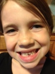 Kiki looses first tooth May 2012